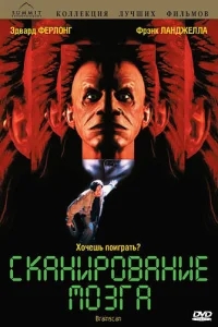 Сканирование мозга Сканирование мозга